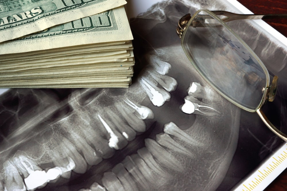 cash money over xray of teeth
