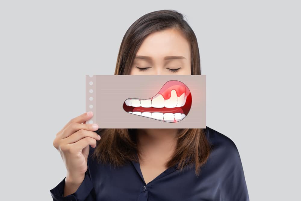 Asian woman in the dark blue shirt holding a paper with the broken tooth cartoon picture of his mouth against the gray background